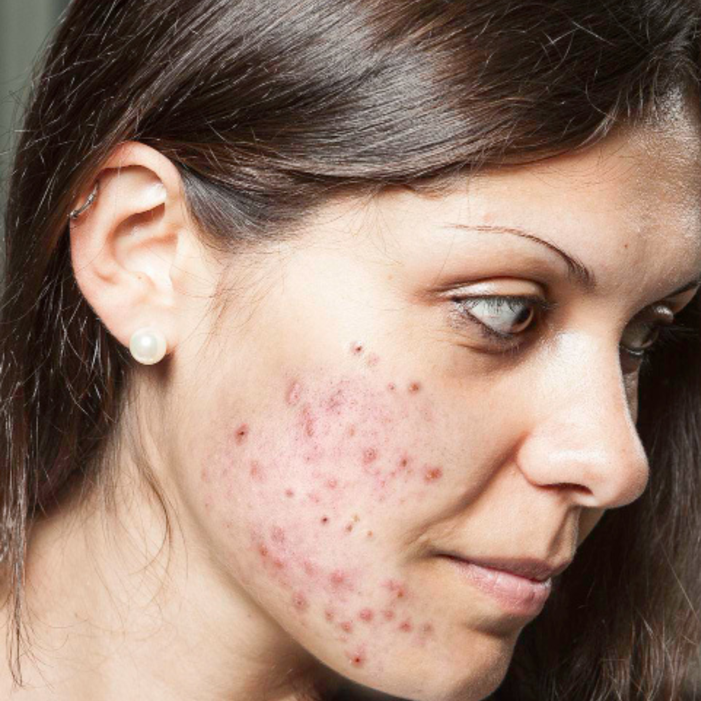 Skin Barrier Repair Combo - SECRET TATTVA