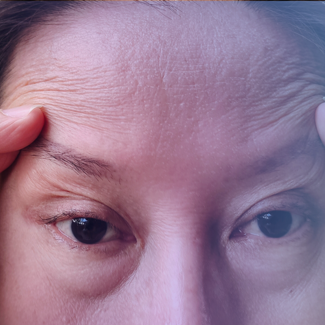 Sweet Almond Oil for Dark Circles & Fine Lines - SECRET TATTVA