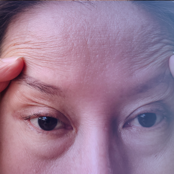 Sweet Almond Oil for Dark Circles & Fine Lines