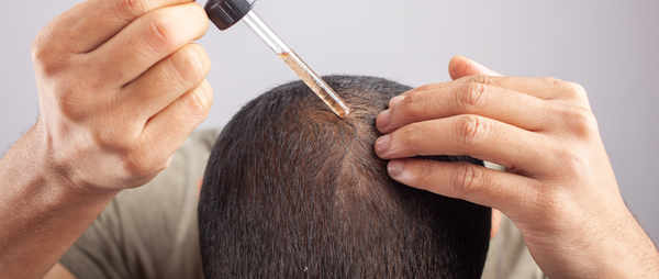 Rosemary Oil vs Minoxidil for Hair Growth: What Does Science Say?