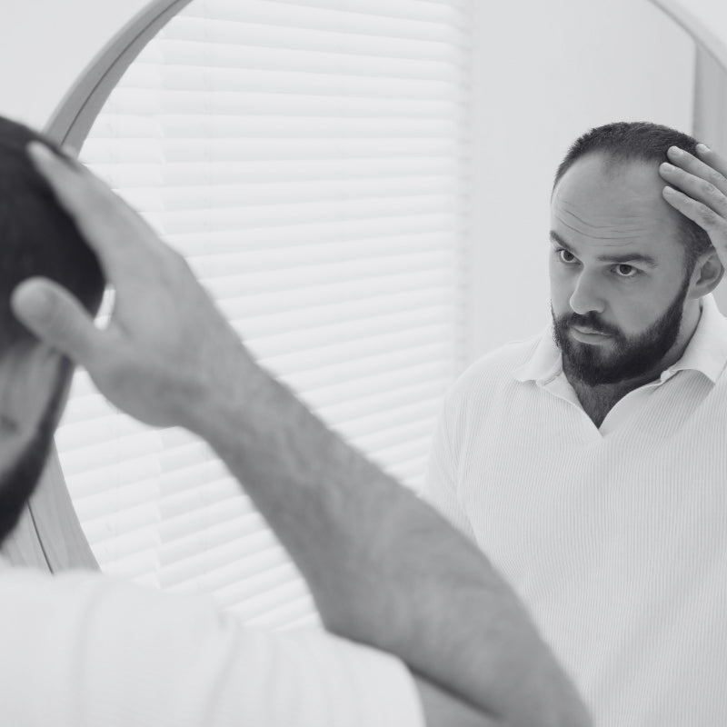 HAIR GROWTH (RECEDING HAIR LINE) - SECRET TATTVA