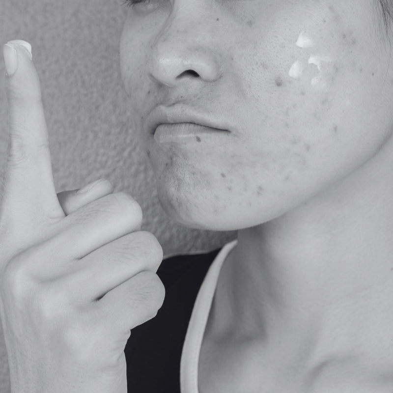 SKIN BARRIER DAMAGE - SECRET TATTVA
