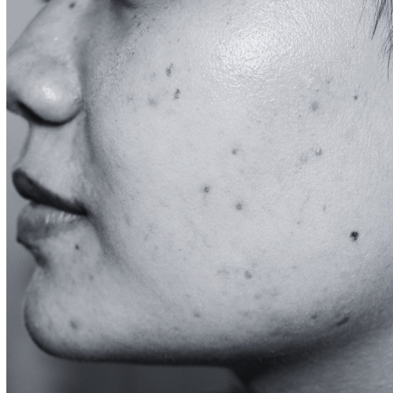 PIGMENTATION /DARK SPOTS - SECRET TATTVA