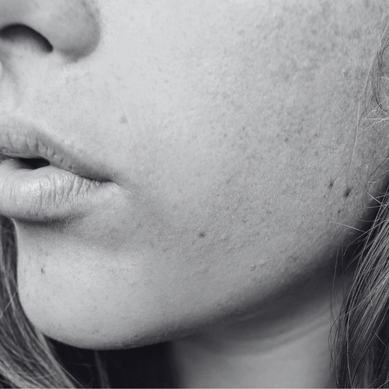 DRY SKIN / DULL SKIN - SECRET TATTVA