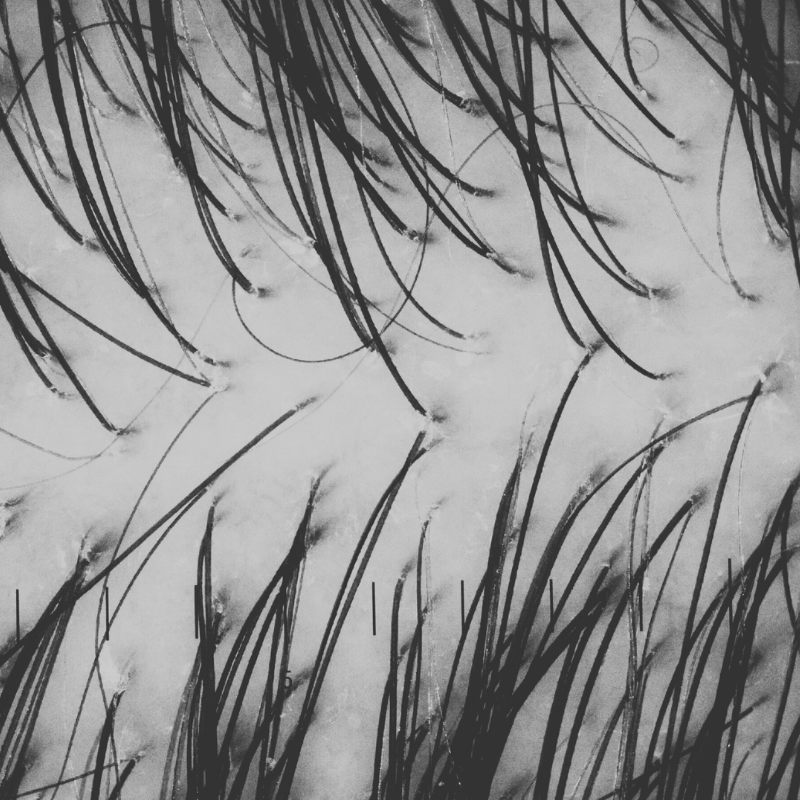 SCALP NOURISHMENT - SECRET TATTVA