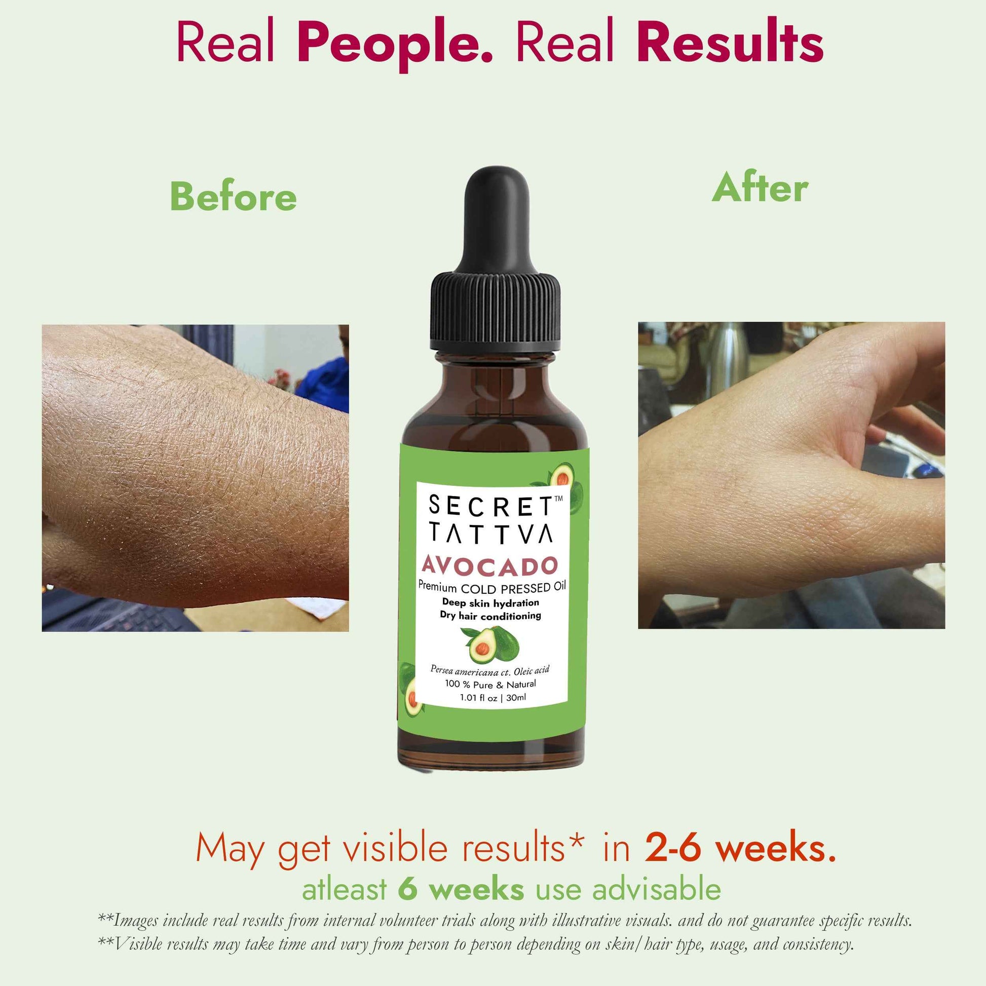 Avocado  Oil for Dry Hair, Skin Hydration