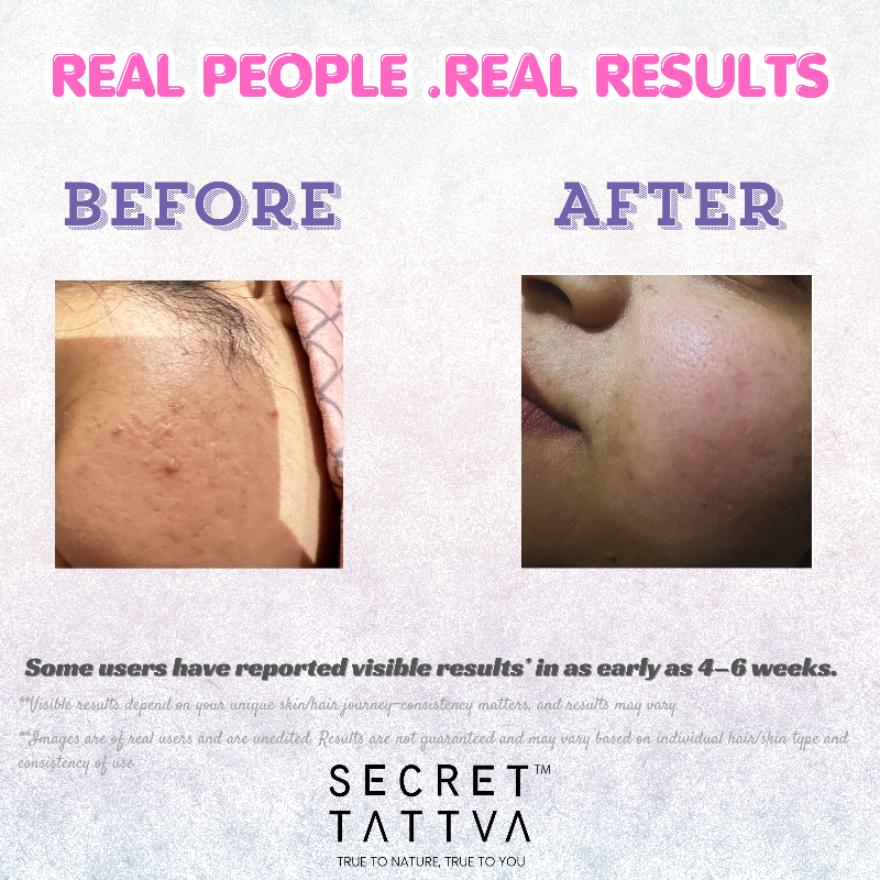 Dark Spots + Skin Glow Combo - SECRET TATTVA