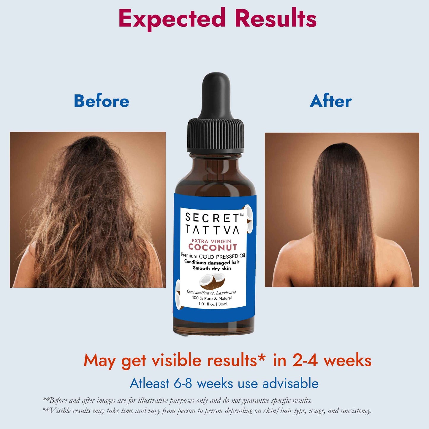 Extra Virgin Coconut Oil for Dry Hair, Dry Skin, Baby Massage