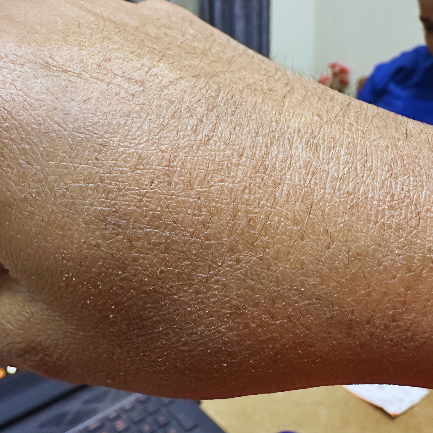 Dry Skin Combo - SECRET TATTVA