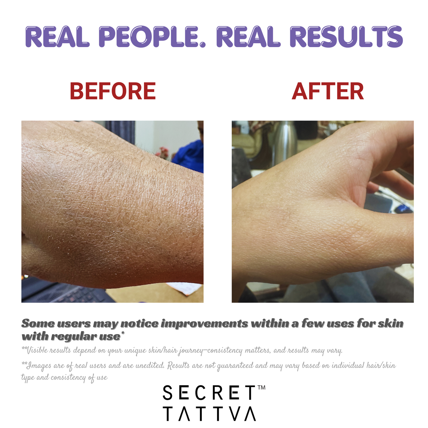 Dry Skin Combo - SECRET TATTVA