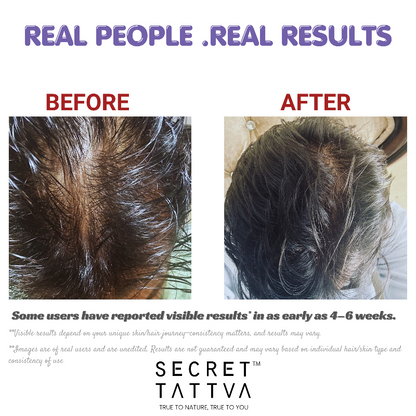 Hair Fall + Hair Growth Combo - SECRET TATTVA