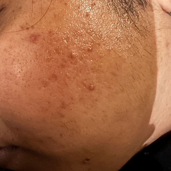 Before