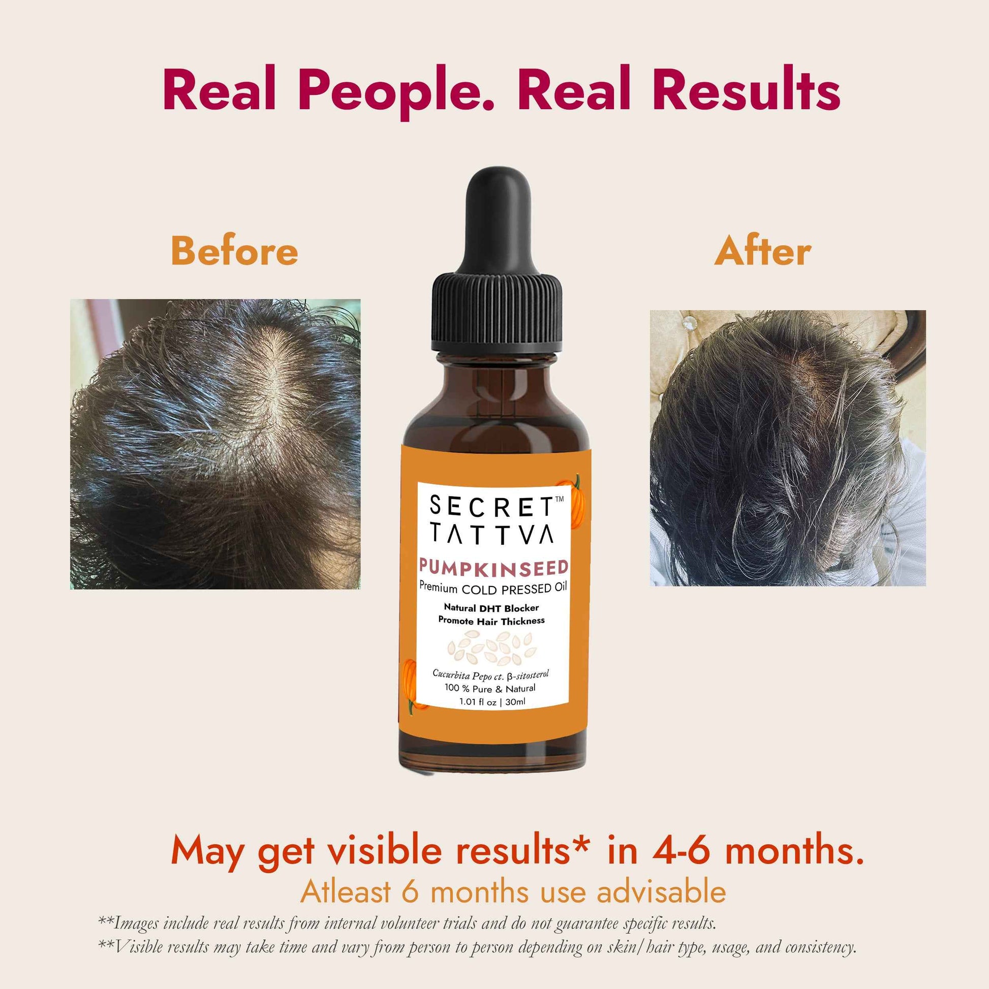 Pumpkinseed Oil for Hair Fall & Hair thinning
