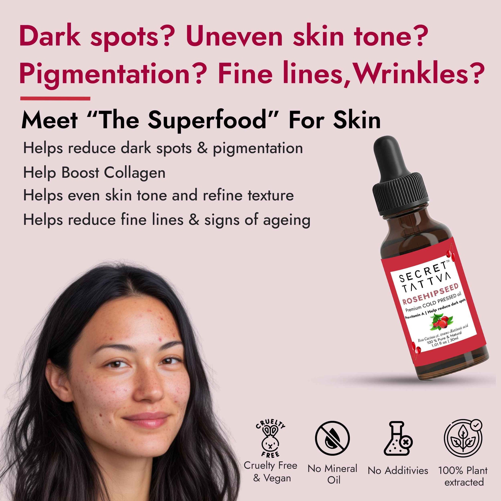 Rosehipseed Oil for Dark Spots, Pigmentation & Wrinkles