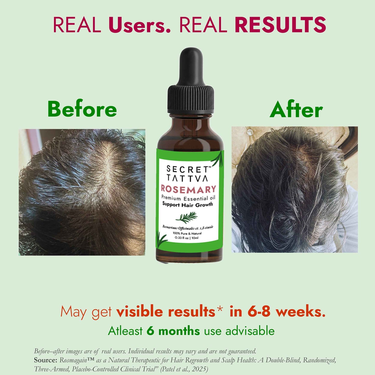 Rosemary Essential Oil - Hair Regrowth, Fall Control