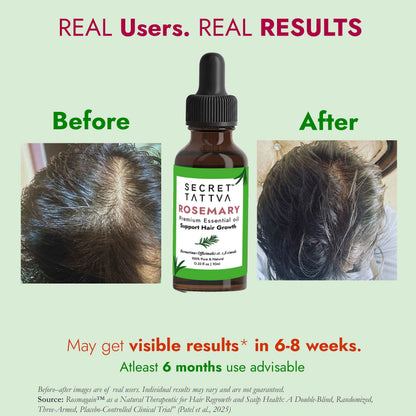 Rosemary Essential Oil - Hair Regrowth, Fall Control