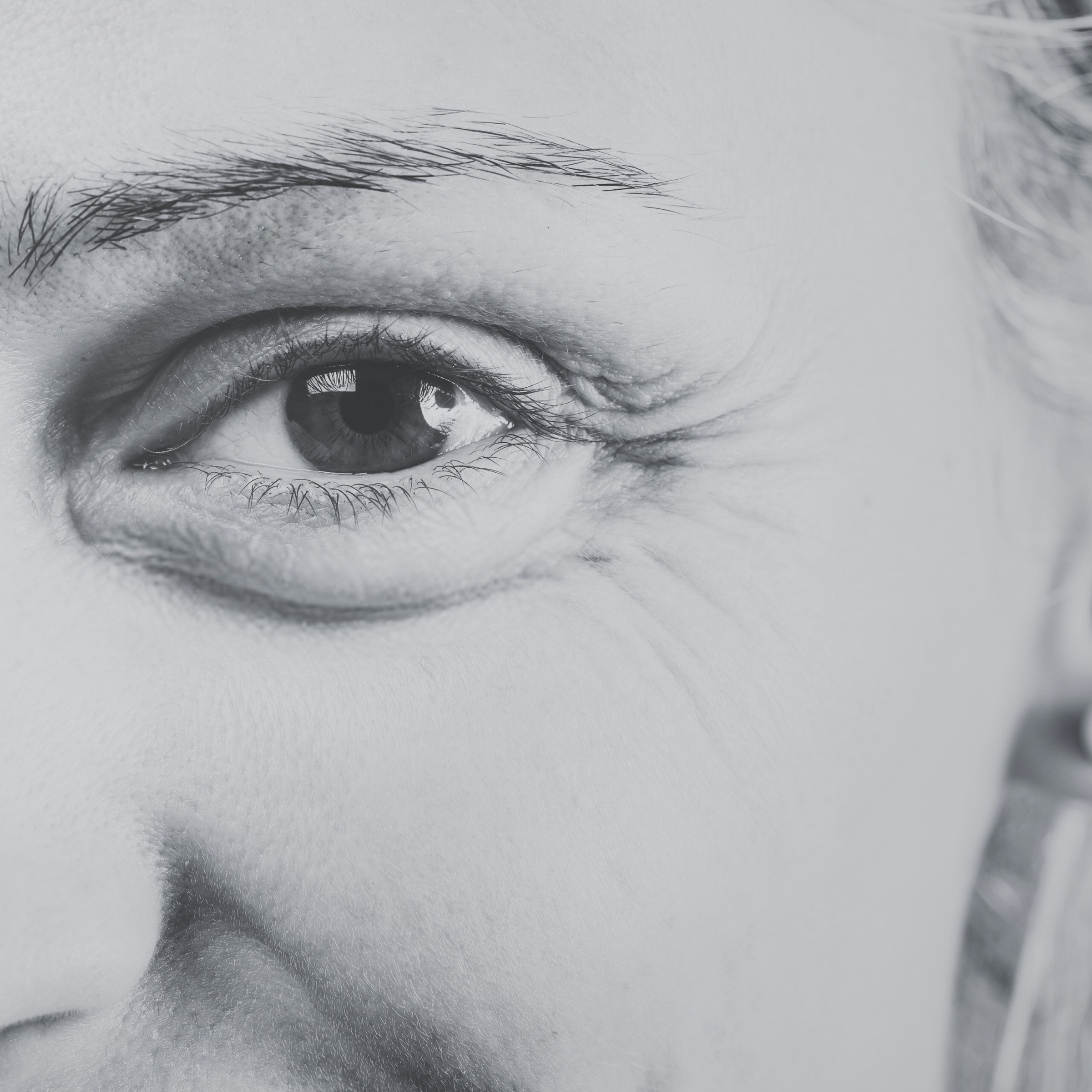 Wrinkles/ Fine Lines Combo