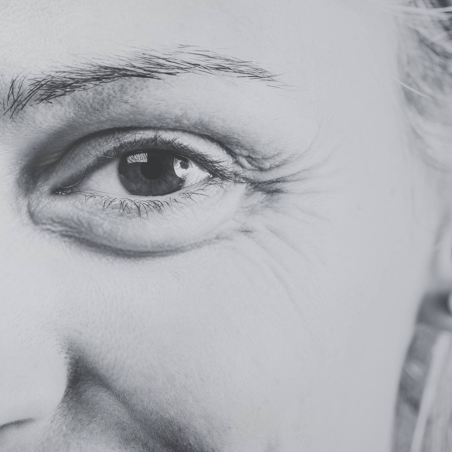 Wrinkles/ Fine Lines Combo